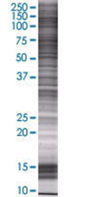 BCOR transfected lysate.