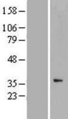 Western Blot: CCNYL1 Overexpression Lysate (Adult Normal) [NBP2-05351] Left-Empty vector transfected control cell lysate (HEK293 cell lysate); Right -Over-expression Lysate for CCNYL1.