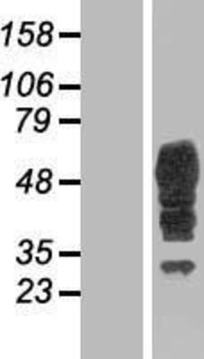 Western Blot: Bestrophin 3 Overexpression Lysate (Adult Normal) [NBP2-05368] Left-Empty vector transfected control cell lysate (HEK293 cell lysate); Right -Over-expression Lysate for Bestrophin 3.