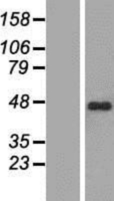 Western Blot: ZNF785 Overexpression Lysate (Adult Normal) [NBP2-05359] Left-Empty vector transfected control cell lysate (HEK293 cell lysate); Right -Over-expression Lysate for ZNF785.