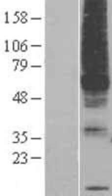Western Blot: PIGM Overexpression Lysate (Adult Normal) [NBP2-05498] Left-Empty vector transfected control cell lysate (HEK293 cell lysate); Right -Over-expression Lysate for PIGM.