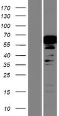 Western Blot: NKX2.3 Overexpression Lysate (Adult Normal) [NBP2-05494] Left-Empty vector transfected control cell lysate (HEK293 cell lysate); Right -Over-expression Lysate for NKX2.3.