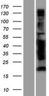 Western Blot: ANKS4B Overexpression Lysate (Adult Normal) [NBP2-05456] Left-Empty vector transfected control cell lysate (HEK293 cell lysate); Right -Over-expression Lysate for ANKS4B.