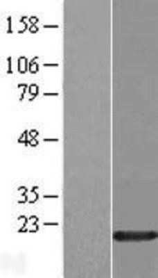 Western Blot: HMGA1 Overexpression Lysate (Adult Normal) [NBP2-05453] Left-Empty vector transfected control cell lysate (HEK293 cell lysate); Right -Over-expression Lysate for HMGA1.