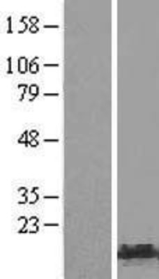 Western Blot: HMGA1 Overexpression Lysate (Adult Normal) [NBP2-05451] Left-Empty vector transfected control cell lysate (HEK293 cell lysate); Right -Over-expression Lysate for HMGA1.