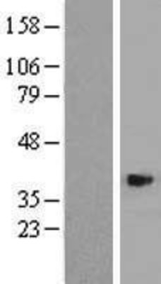 Western Blot: ASB4 Overexpression Lysate (Adult Normal) [NBP2-05448] Left-Empty vector transfected control cell lysate (HEK293 cell lysate); Right -Over-expression Lysate for ASB4.