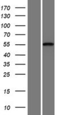 Western Blot: CDH23 Overexpression Lysate (Adult Normal) [NBP2-05857] Left-Empty vector transfected control cell lysate (HEK293 cell lysate); Right -Over-expression Lysate for CDH23.