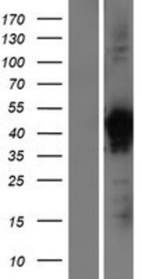 Western Blot: VP26B Overexpression Lysate (Adult Normal) [NBP2-05846] Left-Empty vector transfected control cell lysate (HEK293 cell lysate); Right -Over-expression Lysate for VP26B.