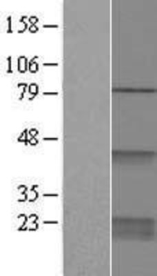 Western Blot: CDC42 Overexpression Lysate (Adult Normal) [NBP2-05863] Left-Empty vector transfected control cell lysate (HEK293 cell lysate); Right -Over-expression Lysate for CDC42.