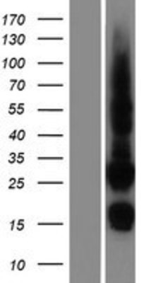 Western Blot: CDK10 Overexpression Lysate (Adult Normal) [NBP2-05828] Left-Empty vector transfected control cell lysate (HEK293 cell lysate); Right -Over-expression Lysate for CDK10.