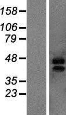 Western Blot: MARVELD3 Overexpression Lysate (Adult Normal) [NBP2-05854] Left-Empty vector transfected control cell lysate (HEK293 cell lysate); Right -Over-expression Lysate for MARVELD3.