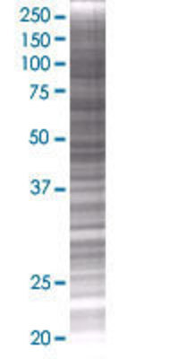ACO1 transfected lysate.