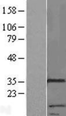 Western Blot: RNF133 Overexpression Lysate (Adult Normal) [NBP2-05594] Left-Empty vector transfected control cell lysate (HEK293 cell lysate); Right -Over-expression Lysate for RNF133.