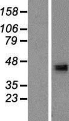 Western Blot: DHRS13 Overexpression Lysate (Adult Normal) [NBP2-05548] Left-Empty vector transfected control cell lysate (HEK293 cell lysate); Right -Over-expression Lysate for DHRS13.