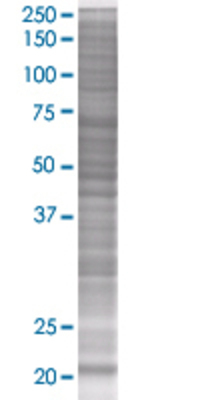 ANAPC10 transfected lysate