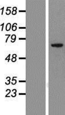 Western Blot: CCDC151 Overexpression Lysate (Adult Normal) [NBP2-05509] Left-Empty vector transfected control cell lysate (HEK293 cell lysate); Right -Over-expression Lysate for CCDC151.