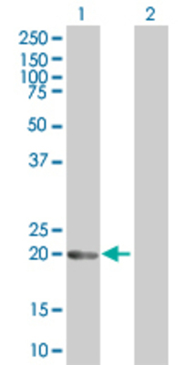 Lane 1: ANAPC10 transfected lysate (21.3 KDa). Lane 2: Non-transfected lysate.