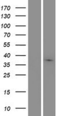Western Blot: MARCH9 Overexpression Lysate (Adult Normal) [NBP2-05669] Left-Empty vector transfected control cell lysate (HEK293 cell lysate); Right -Over-expression Lysate for MARCH9.