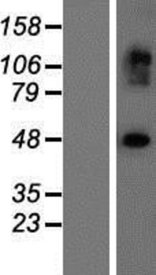 Western Blot: EXOC3L2 Overexpression Lysate (Adult Normal) [NBP2-05645] Left-Empty vector transfected control cell lysate (HEK293 cell lysate); Right -Over-expression Lysate for EXOC3L2.