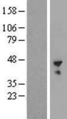 Western Blot: B3GNT6 Overexpression Lysate (Adult Normal) [NBP2-05642] Left-Empty vector transfected control cell lysate (HEK293 cell lysate); Right -Over-expression Lysate for B3GNT6.