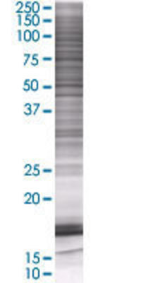C1R transfected lysate.