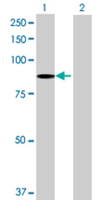 Lane 1: C1R transfected lysate (77.66 KDa) Lane 2: Non-transfected lysate.