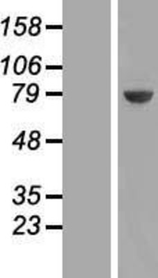 Western Blot: UCKL1 Overexpression Lysate (Adult Normal) [NBP2-06875] Left-Empty vector transfected control cell lysate (HEK293 cell lysate); Right -Over-expression Lysate for UCKL1.