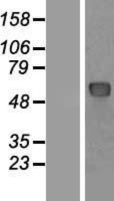 Western Blot: Nucleoporin p62 Overexpression Lysate (Adult Normal) [NBP2-07019] Left-Empty vector transfected control cell lysate (HEK293 cell lysate); Right -Over-expression Lysate for Nucleoporin p62.