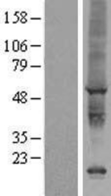 Western Blot: AIG1 Overexpression Lysate (Adult Normal) [NBP2-07090] Left-Empty vector transfected control cell lysate (HEK293 cell lysate); Right -Over-expression Lysate for AIG1.