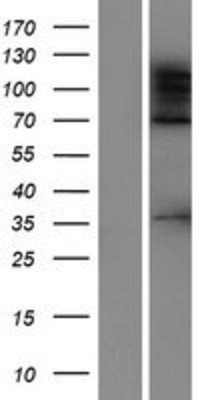 Western Blot: ADNP2 Overexpression Lysate (Adult Normal) [NBP2-07253] Left-Empty vector transfected control cell lysate (HEK293 cell lysate); Right -Over-expression Lysate for ADNP2.