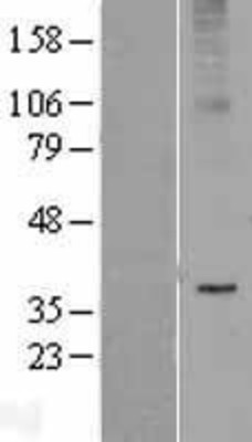 Western Blot: Adiponectin Receptor 2 Overexpression Lysate (Adult Normal) [NBL1-07344] Left-Empty vector transfected control cell lysate (HEK293 cell lysate); Right -Over-expression Lysate for Adiponectin Receptor 2.