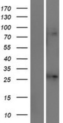 Western Blot: KCNJ1 Overexpression Lysate (Adult Normal) [NBL1-12162] Left-Empty vector transfected control cell lysate (HEK293 cell lysate); Right -Over-expression Lysate for KCNJ1.