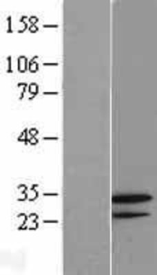 Western Blot: GNPDA2 Overexpression Lysate (Adult Normal) [NBL1-11189] Left-Empty vector transfected control cell lysate (HEK293 cell lysate); Right -Over-expression Lysate for GNPDA2.