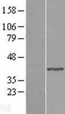 Western Blot: ABHD4 Overexpression Lysate (Adult Normal) [NBL1-07198] Left-Empty vector transfected control cell lysate (HEK293 cell lysate); Right -Over-expression Lysate for ABHD4.