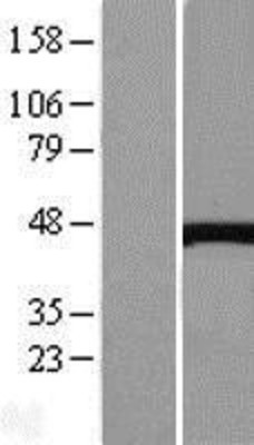 Western Blot: Cystathionase Overexpression Lysate (Adult Normal) [NBL1-09573] Left-Empty vector transfected control cell lysate (HEK293 cell lysate); Right -Over-expression Lysate for Cystathionase.
