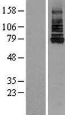 Western Blot: IRAK Overexpression Lysate (Adult Normal) [NBL1-12026] Left-Empty vector transfected control cell lysate (HEK293 cell lysate); Right -Over-expression Lysate for IRAK.