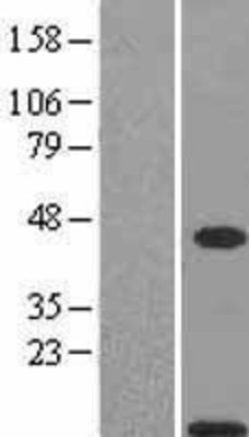 Western Blot: S100A11 Overexpression Lysate (Adult Normal) [NBL1-15649] Left-Empty vector transfected control cell lysate (HEK293 cell lysate); Right -Over-expression Lysate for S100A11.