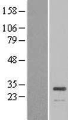 Western Blot: ATP6V1E1 Overexpression Lysate (Adult Normal) [NBL1-07843] Left-Empty vector transfected control cell lysate (HEK293 cell lysate); Right -Over-expression Lysate for ATP6V1E1.