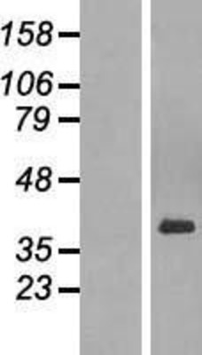 Western Blot: PAR6 Overexpression Lysate (Adult Normal) [NBL1-14102] Left-Empty vector transfected control cell lysate (HEK293 cell lysate); Right -Over-expression Lysate for PAR6.