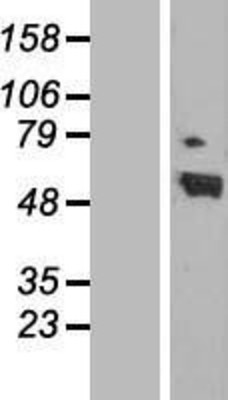 Western Blot: Retinoic Acid Receptor alpha Overexpression Lysate (Adult Normal) [NBL1-15156] Left-Empty vector transfected control cell lysate (HEK293 cell lysate); Right -Over-expression Lysate for Retinoic Acid Receptor alpha.