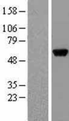 Western Blot: GPT Overexpression Lysate (Adult Normal) [NBL1-11312] Left-Empty vector transfected control cell lysate (HEK293 cell lysate); Right -Over-expression Lysate for GPT.