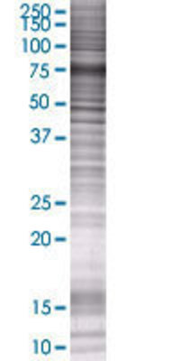 SIPA1L2 transfected lysate.