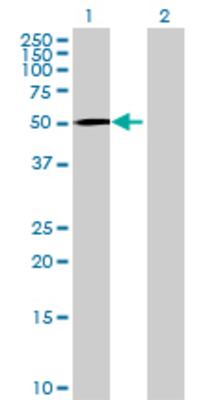 Lane 1: SOAT1 transfected lysate (60.61 KDa) Lane 2: Non-transfected lysate.