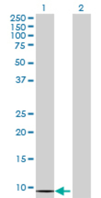 Lane 1: ERC1 transfected lysate (10.12 KDa) Lane 2: Non-transfected lysate.
