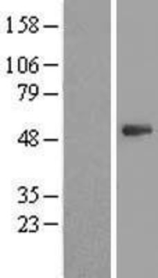 Western Blot: PSMD11 Overexpression Lysate (Adult Normal) [NBL1-14896] Left-Empty vector transfected control cell lysate (HEK293 cell lysate); Right -Over-expression Lysate for PSMD11.