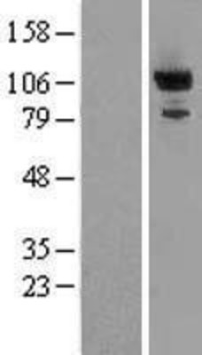 Western Blot: PDE2A Overexpression Lysate (Adult Normal) [NBL1-14216] Left-Empty vector transfected control cell lysate (HEK293 cell lysate); Right -Over-expression Lysate for PDE2A.