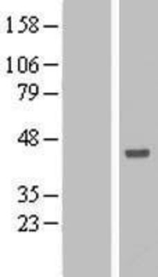 Western Blot: ANKRD53 Overexpression Lysate (Adult Normal) [NBL1-07545] Left-Empty vector transfected control cell lysate (HEK293 cell lysate); Right -Over-expression Lysate for ANKRD53.
