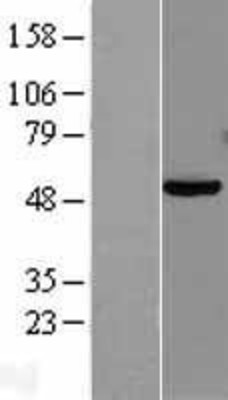 Western Blot: PAX8 Overexpression Lysate (Adult Normal) [NBL1-14132] Left-Empty vector transfected control cell lysate (HEK293 cell lysate); Right -Over-expression Lysate for PAX8.