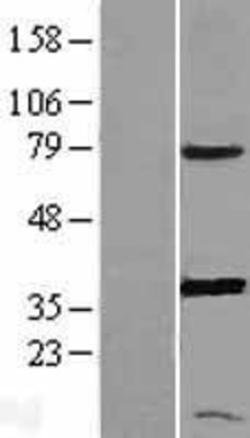 Western Blot: PGR1 Overexpression Lysate (Adult Normal) [NBL1-14941] Left-Empty vector transfected control cell lysate (HEK293 cell lysate); Right -Over-expression Lysate for PGR1.