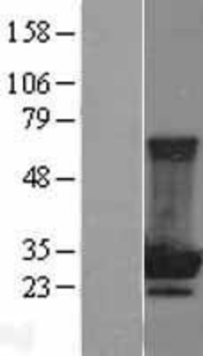 Western Blot: MOBKL2B Overexpression Lysate (Adult Normal) [NBL1-13172] Left-Empty vector transfected control cell lysate (HEK293 cell lysate); Right -Over-expression Lysate for MOBKL2B.